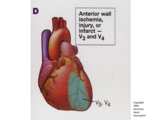 Copyright  2001  American  Heart  Association 