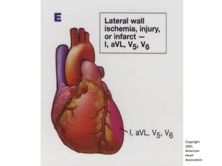 Copyright  2001  American  Heart  Association 