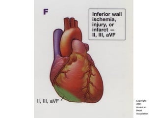 Copyright  2001  American  Heart  Association 