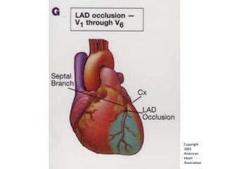 Copyright  2001  American  Heart  Association 