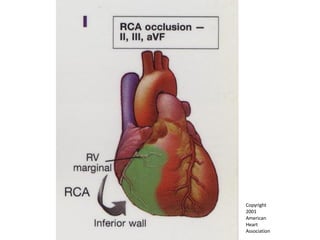 Copyright  2001  American  Heart  Association 