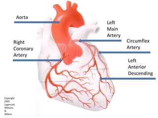 Aorta Right  Coronary Artery Left  Main Artery Left Anterior Descending Circumflex Artery  Copyright  2005 Lippincott  Williams  & Wilkins 