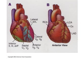Copyright 2001 American Heart Association 
