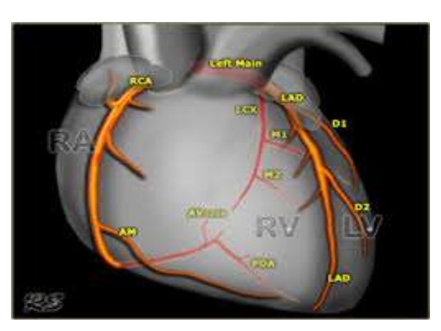 Coronary anatomy for Interventional Cardiologists toufiqur ...