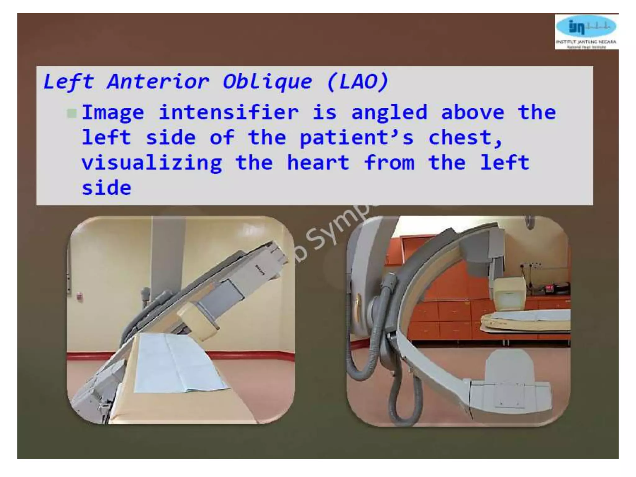 Coronary anatomy and angiographic views | PPTX