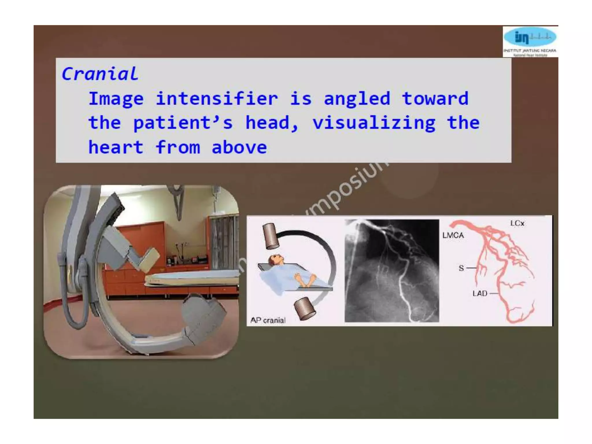 Coronary anatomy and angiographic views | PPTX