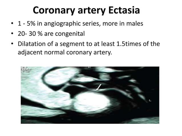 Coronary anatomy and angiographic views | PPTX