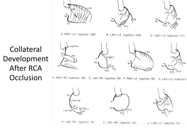 Coronary anatomy and angiographic views | PPTX