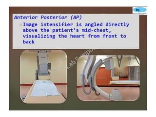 Coronary anatomy and angiographic views | PPTX