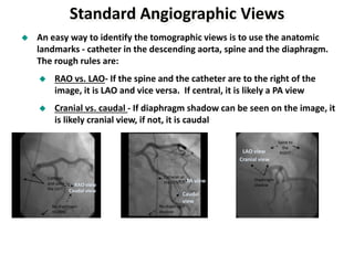 Coronary anatomy and angiographic views | PPTX