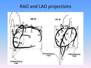 CORONARY ANATOMY _ SANDEEP M CAG VIEWS.ppsx
