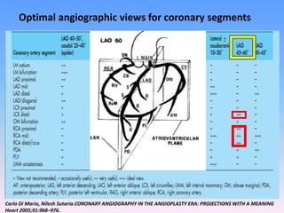 CORONARY ANATOMY _ SANDEEP M CAG VIEWS.ppsx