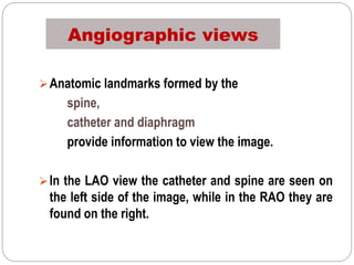 Angiographic views
Anatomic landmarks formed by the
spine,
catheter and diaphragm
provide information to view the image.
In the LAO view the catheter and spine are seen on
the left side of the image, while in the RAO they are
found on the right.
 