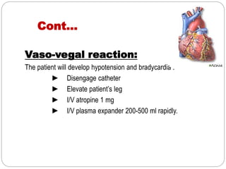 Cont…
Vaso-vegal reaction:
The patient will develop hypotension and bradycardia .
► Disengage catheter
► Elevate patient’s leg
► I/V atropine 1 mg
► I/V plasma expander 200-500 ml rapidly.
 