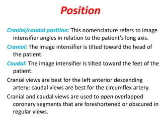 Position
Cranial/caudal position: This nomenclature refers to image
intensifier angles in relation to the patient's long axis.
Cranial: The image intensifier is tilted toward the head of
the patient.
Caudal: The image intensifier is tilted toward the feet of the
patient.
Cranial views are best for the left anterior descending
artery; caudal views are best for the circumflex artery.
Cranial and caudal views are used to open overlapped
coronary segments that are foreshortened or obscured in
regular views.
 