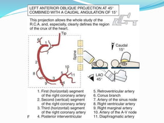 Coronary angiograpgy basic n special views by Author- Dr Surg Capt ...
