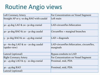 Coronary angiograpgy basic n special views by Author- Dr Surg Capt ...