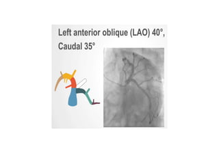 Coronary Angiographic Views final presentation.pptx