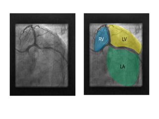 Coronary Angiographic Views final presentation.pptx