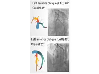 Coronary Angiographic Views final presentation.pptx