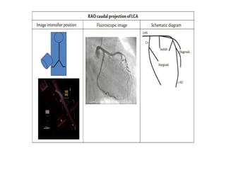 Coronary Angiographic Views final presentation.pptx