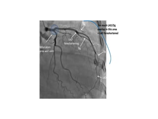 Coronary Angiographic Views final presentation.pptx