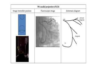 Coronary Angiographic Views final presentation.pptx