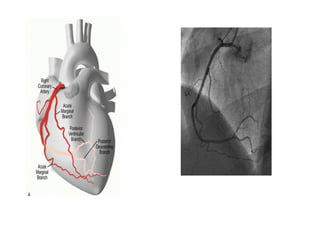 Coronary Angiographic Views final presentation.pptx