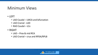 Coronary Angiography - Views - Dr Hafeesh Fazulu - PIMS.pptx