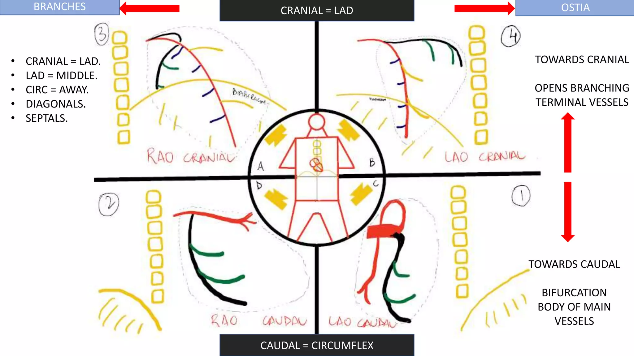 CORONARY ANGIOGRAPHY INTERPRET.pptx