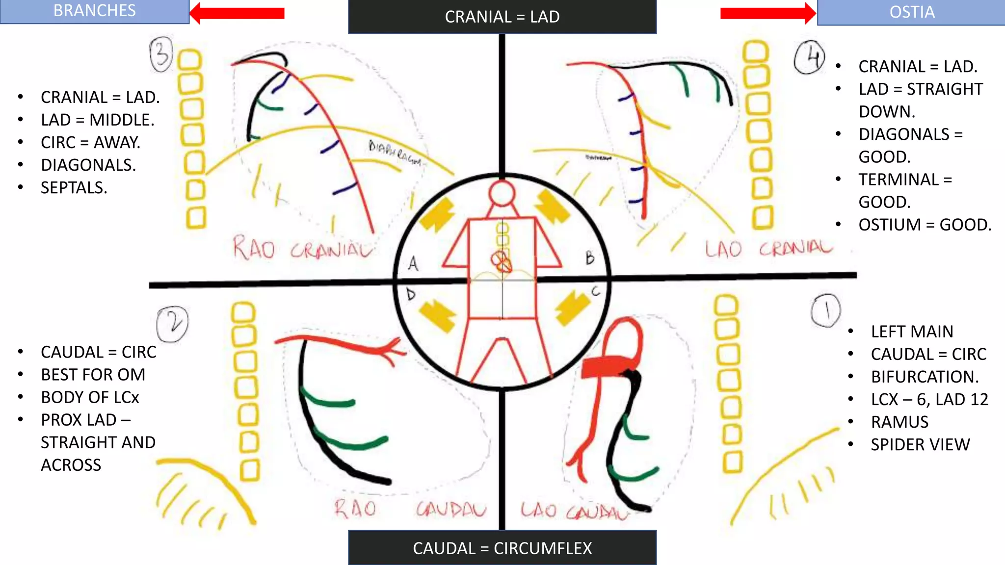 CORONARY ANGIOGRAPHY INTERPRET.pptx