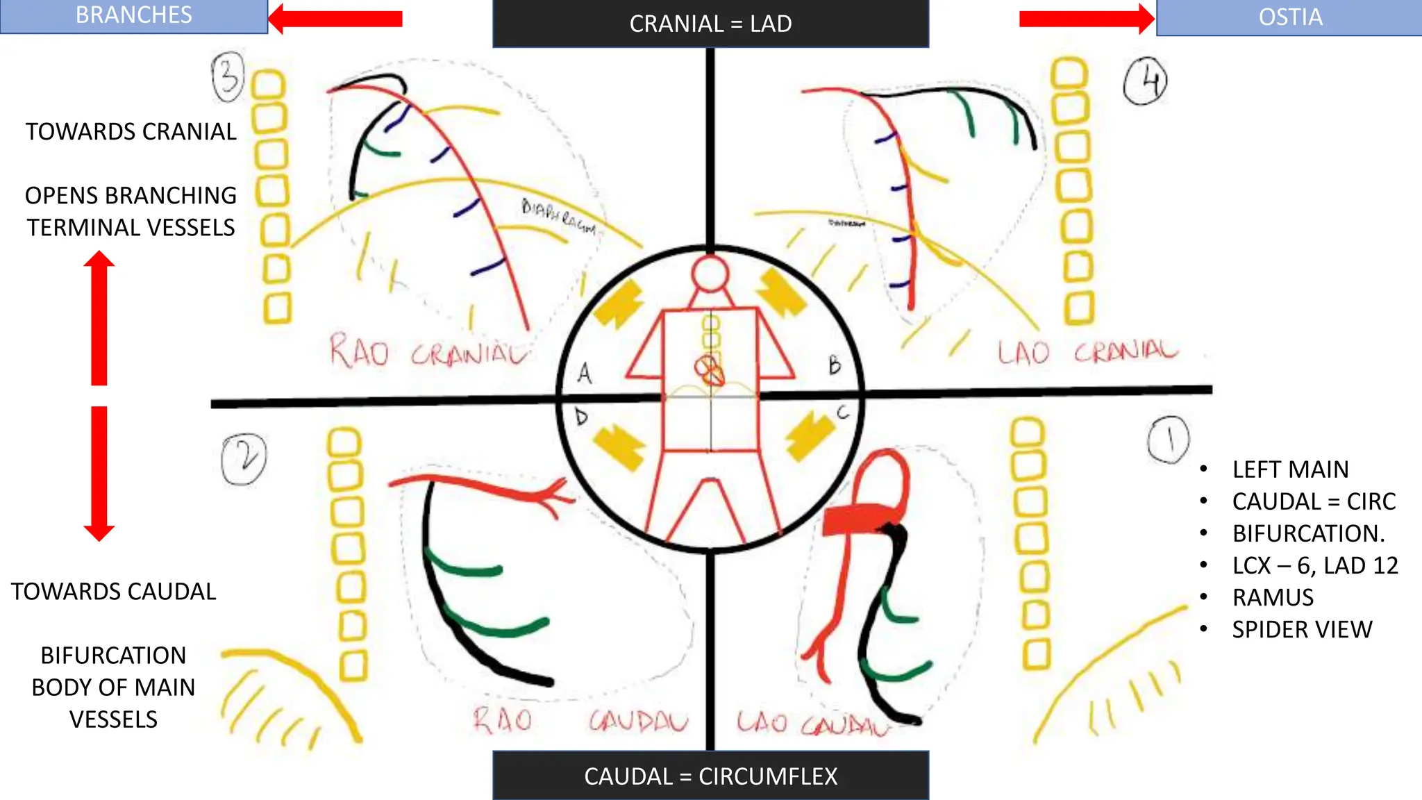 CORONARY ANGIOGRAPHY INTERPRET(Coronary Angios).pptx