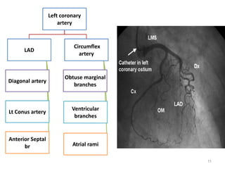 Marginal Ramus coronaryangiographymadhu-151130170912-lva1-app6892 (1).pdf