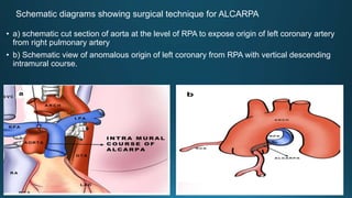CORONARY ARTERY ANOMALIES MZ. Cardiology, Spandana collection pptx | PPTX