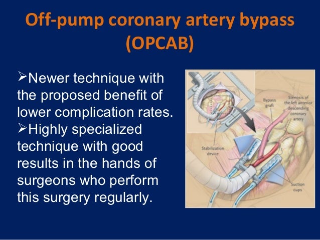 risk factors in coronary artery bypass graft Off pump coronary artery bypass graft surgery risk factors that can increase the chance of complications following off-pump coronary artery bypass surgery include. risk factors in coronary artery bypass graft Off pump coronary artery bypass graft surgery risk factors that can increase the chance of complications following off-pump coronary artery bypass surgery include.