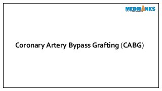 Coronary Artery Bypass Grafting (CABG)
 