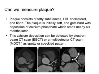 Coronary artery calcium scoring IDoR 2018 | PDF