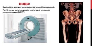 ВИДИ:
За кількістю досліджуваних судин: загальний і селективний.
Третій метод- мультиспіральна компютерна томографія
коронарних судин(МСКТ).
 