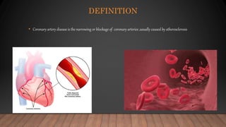 CORONARY ARTERY DISEASE.pptx