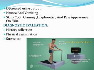  Decreased urine output.
 Nausea And Vomiting
 Skin- Cool, Clammy ,Diaphoretic , And Pale Appearance
On Skin.
DIAGNOSTIC EVALUATION:
History collection
Physical examination
Stress test
 
