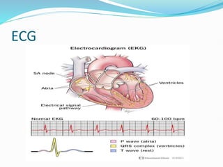 ECG
 
