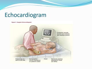 Echocardiogram
 