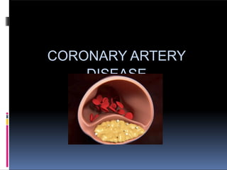 coronary artery disease and its prevention. | PPTX