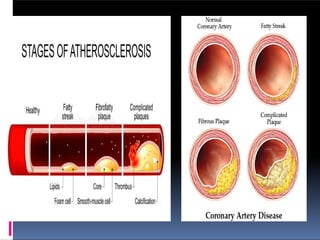 coronary artery disease and its prevention. | PPTX