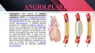 Coronary artery diseases | PPTX
