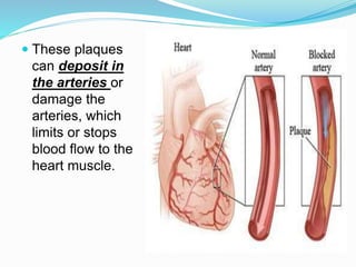 Coronary artery diseases. | PPTX