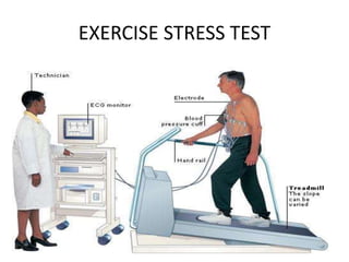 EXERCISE STRESS TEST
 