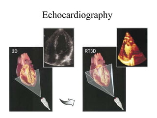 Echocardiography
 