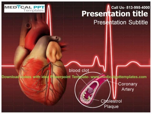 Congenital Heart Disease Ppt Download