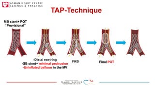 Stent Coronary Bifurcation techniques in a nutshell | PDF